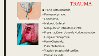 Hemorragia del post parto | PPT