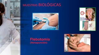 Flebotomía
(Venopunción)
MUESTRAS BIOLÓGICAS
 