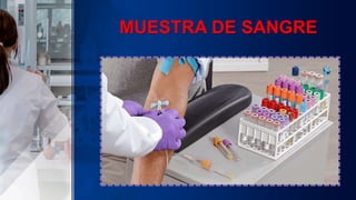 MUESTRA DE SANGRE
 