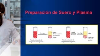 Preparación de Suero y Plasma
 