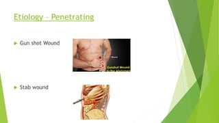 Etiology – Penetrating
 Gun shot Wound
 Stab wound
 