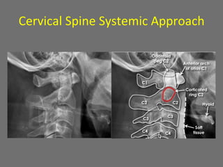Cervical Spine Systemic Approach
 