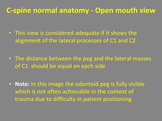 C-spine normal anatomy - Open mouth view
• This view is considered adequate if it shows the
alignment of the lateral processes of C1 and C2
• The distance between the peg and the lateral masses
of C1 should be equal on each side
• Note: In this image the odontoid peg is fully visible
which is not often achievable in the context of
trauma due to difficulty in patient positioning
 