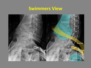 Swimmers View
 