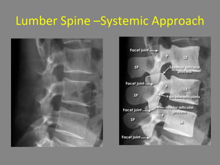 Lumber Spine –Systemic Approach
 