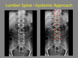 Lumber Spine –Systemic Approach
 