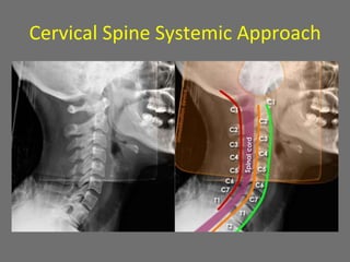 Cervical Spine Systemic Approach
 