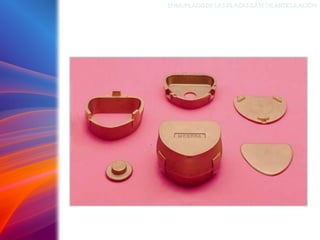 ENMUFLADODELAS PLACAS BASEDEARTICULACIÓN
 