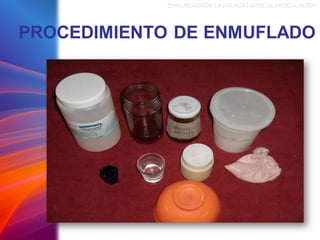 PROCEDIMIENTO DE ENMUFLADO
ENMUFLADODELAS PLACAS BASEDEARTICULACIÓN
 