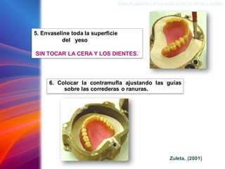 ENMUFLADODELAS PLACAS BASEDEARTICULACIÓN
5. Envaseline toda la superficie
del yeso
SIN TOCAR LA CERA Y LOS DIENTES.
6. Colocar la contramufla ajustando las guías
sobre las correderas o ranuras.
Zuleta, (2001)
 
