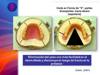 ENMUFLADODELAS PLACAS BASEDEARTICULACIÓN
Corte en Forma de “V”, partes
divergentes, hacia afuera
(expulsiva)
“Eliminación del yeso con más facilidad en el
desmuflado y disminuye el riesgo de fracturar la
prótesis.”
Zuleta, (2001)
 