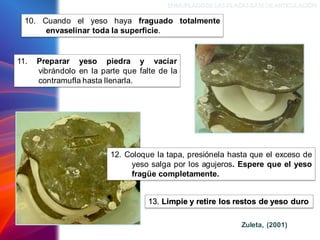 ENMUFLADODELAS PLACAS BASEDEARTICULACIÓN
10. Cuando el yeso haya fraguado totalmente
envaselinar toda la superficie.
Zuleta, (2001)
11. Preparar yeso piedra y vacíar
vibrándolo en la parte que falte de la
contramufla hasta llenarla.
12. Coloque la tapa, presiónela hasta que el exceso de
yeso salga por los agujeros. Espere que el yeso
fragüe completamente.
13. Limpie y retire los restos de yeso duro
 