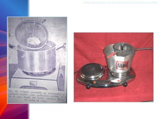 ENMUFLADODELAS PLACAS BASEDEARTICULACIÓN
 