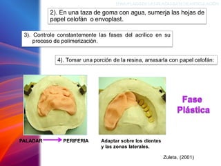 3). Controle constantemente las fases del acrílico en su
proceso de polimerización.
ENMUFLADODELAS PLACAS BASEDEARTICULACIÓN
Zuleta, (2001)
2). En una taza de goma con agua, sumerja las hojas de
papel celofán o envoplast.
4). Tomar una porción de la resina, amasarla con papel celofán:
PALADAR Adaptar sobre los dientes
y las zonas laterales.
PERIFERIA
 