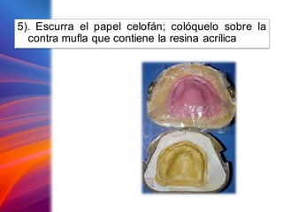 5). Escurra el papel celofán; colóquelo sobre la
contra mufla que contiene la resina acrílica
 