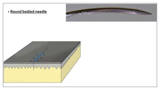 • Round bodied needle
 