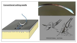 Conventional cutting needle
 