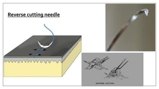 Reverse cutting needle
 