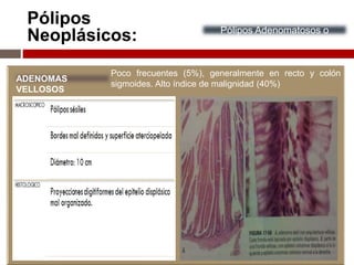 Pólipos
Neoplásicos: Pólipos Adenomatosos o
Adenomas
ADENOMAS
VELLOSOS
Poco frecuentes (5%), generalmente en recto y colón
sigmoides. Alto índice de malignidad (40%)
 