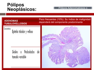 Pólipos
Neoplásicos: Pólipos Adenomatosos o
Adenomas
ADENOMAS
TUBULOVELLOSOS
Poco frecuentes (10%). Su índice de malignidad
dependerá del componente predominante
 