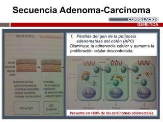 Secuencia Adenoma-Carcinoma
CORRELACION
GÉNETICA
1. Pérdida del gen de la poliposis
adenomatosa del colón (APC)
Disminuye la adherencia celular y aumenta la
proliferación celular descontrolada.
Presente en ˃80% de los carcinomas colorrectales.
 