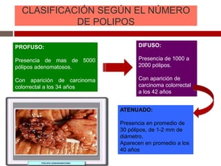 CLASIFICACIÓN SEGÚN EL NÚMERO
DE POLIPOS
PROFUSO:
Presencia de mas de 5000
pólipos adenomatosos.
Con aparición de carcinoma
colorrectal a los 34 años
DIFUSO:
Presencia de 1000 a
2000 pólipos.
Con aparición de
carcinoma colorrectal
a los 42 años
ATENUADO:
Presencia en promedio de
30 pólipos, de 1-2 mm de
diámetro.
Aparecen en promedio a los
40 años
 