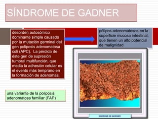 SÍNDROME DE GADNER
desorden autosómico
dominante simple causado
por la mutación germinal del
gen poliposis adenomatosa
coli (APC). La pérdida de
éste gen de supresión
tumoral multifunción, que
media la adhesión celular es
el evento más temprano en
la formación de adenomas.
una variante de la poliposis
adenomatosa familiar (FAP)
pólipos adenomatosos en la
superficie mucosa intestinal,
que tienen un alto potencial
de malignidad
 