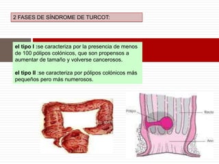 el tipo I :se caracteriza por la presencia de menos
de 100 pólipos colónicos, que son propensos a
aumentar de tamaño y volverse cancerosos.
el tipo II :se caracteriza por pólipos colónicos más
pequeños pero más numerosos.
2 FASES DE SÍNDROME DE TURCOT:
 