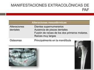 MANIFESTACIONES EXTRACOLÓNICAS DE
PAF
Alteraciones mesodérmicas
Alteraciones
dentales
Dientes supernumerarios
Ausencia de piezas dentales
Fusión de raíces de los dos primeros molares.
Raíces muy largas
Osteomas Principalmente en la mandíbula
 