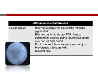 Alteraciones ectodérmicas
Lesión ocular Hipertrofia congénita del epitelio retiniano
pigmentado.
Examen de fondo de ojo, FAR. Lesión
pigmentada aislada, plana, delimitada, forma
oval con un halo pálido.
Por lo menos 4 lesiones entre ambos ojos.
Prevalencia : 90% en PAF.
Bilateral 78%
 
