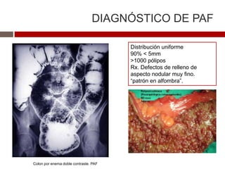 DIAGNÓSTICO DE PAF
Distribución uniforme
90% < 5mm
>1000 pólipos
Rx. Defectos de relleno de
aspecto nodular muy fino.
“patrón en alfombra”.
Colon por enema doble contraste. PAF
 