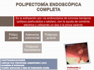 Es la extirpación por vía endoscópica de tumores benignos
(pólipos pediculados o sésiles), con la ayuda de corriente
eléctrica y utilizando un asa o la pinza caliente
Pólipo
juvenil
Adenoma
colorrectal
Poliposis
juvenil
Poliposis
hiperplasica
 
