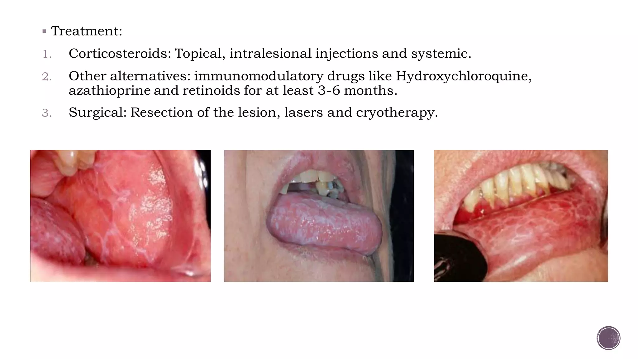 Oral Potentially Malignant Disorders | PDF