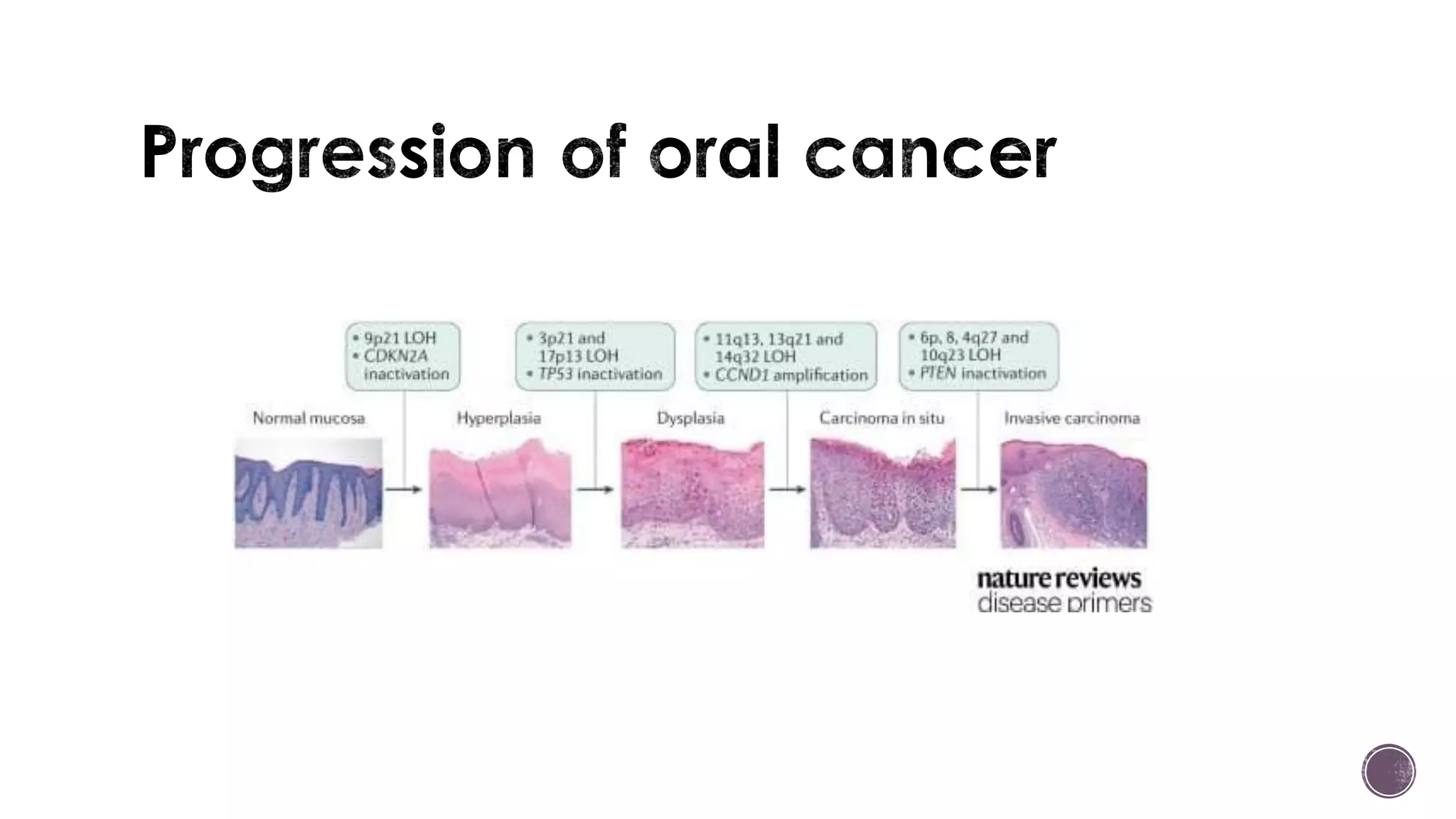 Oral Potentially Malignant Disorders | PDF