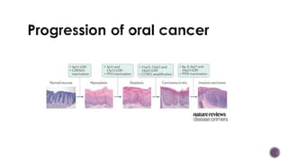 Oral Potentially Malignant Disorders | PDF