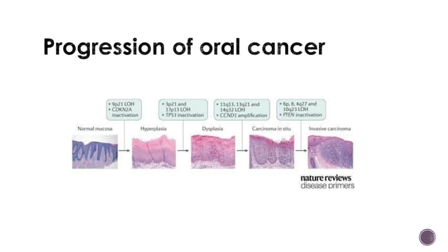 Oral Potentially Malignant Disorders | PDF | Skin and Dermatology ...