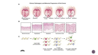 Oral Potentially Malignant Disorders | PDF