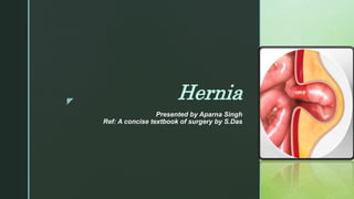 z
Hernia
Presented by Aparna Singh
Ref: A concise textbook of surgery by S.Das
 