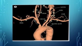 CECT NECK NECK ANGIOGRAPHY CAROTID ANGIOGRAPHY | PDF