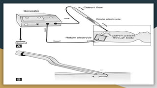 Thermal cautrization | PPTX