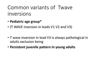 ECG of the week | PPTX