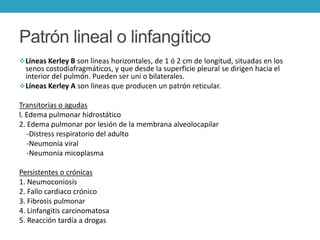 Linfangitis Reticular PATOLOGIA TORACICA TEJIDOS BLANDOS Y OSEOS CLASE LUNES | PPTX