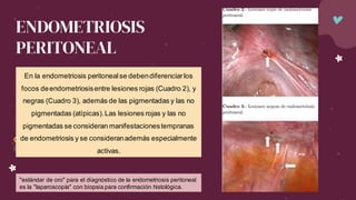 ENDOMETRIOSIS
PERITONEAL
En la endometriosis peritonealse debendiferenciarlos
focos deendometriosisentre lesiones rojas (Cuadro 2), y
negras (Cuadro 3), además de las pigmentadas y las no
pigmentadas (atípicas).Las lesiones rojas y las no
pigmentadas se consideran manifestacionestempranas
de endometriosis y se consideranademás especialmente
activas.
"estándar de oro" para el diagnóstico de la endometriosis peritoneal
es la "laparoscopía" con biopsia para confirmación histológica.
 