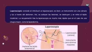 Laparoscopía: consiste en introducir un laparoscopio, es decir, un instrumento con una cámara
y luz a través del abdomen. Así, se extirpan las lesiones, se destruyen y se retira el tejido
cicatricial. La recuperación tras la laparoscopia es mucho más rápida que en el caso de una
cirugía mayor, como la laparatomía.
 