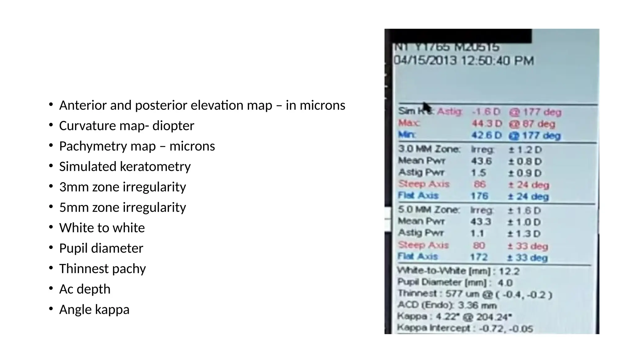 Corneal Topography in ophthalmology.pptx