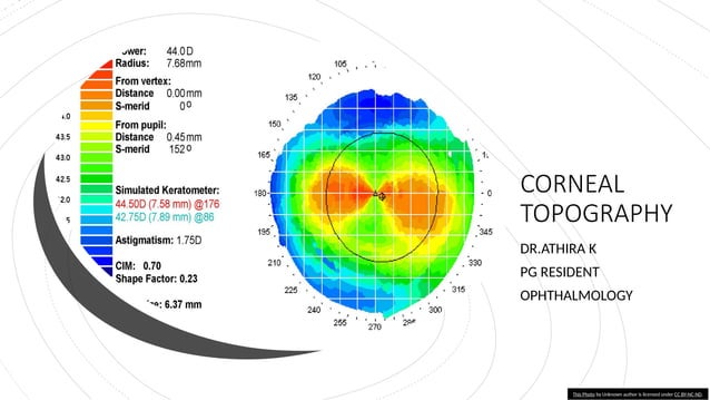 Corneal Topography in ophthalmology.pptx
