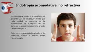 Endotropía acomodativa no refractiva
En este tipo de esotropía acomodativa, el
cociente CA/A es elevado, de modo que
cada unidad de aumento de la
acomodación se acompaña de un
aumento esproporcionadamente grande
de la convergencia.
Ocurre con independencia del defecto de
refracción, aunque a menudo existe
hipermetropía
 
