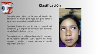Clasificación
Exotropía para lejos, en la que el ángulo de
desviación es mayor para lejos que para cerca y
sigue incrementándose más allá de los 6 m.
Exotropía inespecíica, en la que el control del
estrabismo y el ángulo de desviación son similares
para la fijación de lejos y cerca.
Exotropía de cerca, en la que la desviación es mayor
en la fijación cercana. Suele ocurrir en niños
mayores y adultos y puede asociare a miopía
adquirida o presbicia.
 