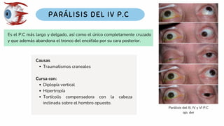 Es el P.C más largo y delgado, así como el único completamente cruzado
y que además abandona el tronco del encéfalo por su cara posterior.
Causas
Traumatismos craneales
Cursa con:
Diplopía vertical
Hipertropía
Tortícolis compensadora con la cabeza
inclinada sobre el hombro opuesto.
Parálisis del III, IV y VI P.C
ojo. der
 