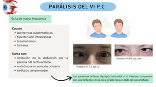 Es la de mayor frecuencia
Causas
por hernias subtentoriales,
hipertensión intracraneal,
traumatismos,
tumores
Cursa con:
limitación de la abducción por la
paresia del recto externo,
endotropía en posición primaria
tortícolis compensador
Los pacientes refieren diplopía horizontal y lo intentan compensar
con una tortícolis con la cara girada hacia el lado del ojo afectado
Parálisis VI P.C ojo. iz
Parálisis VI P.C ojo. der
 